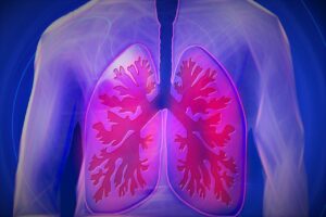 Poumons affectés par la pollution de l'air